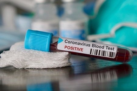 Türkiyədə koronavirusa yoluxanların sayı İranı ötdü
