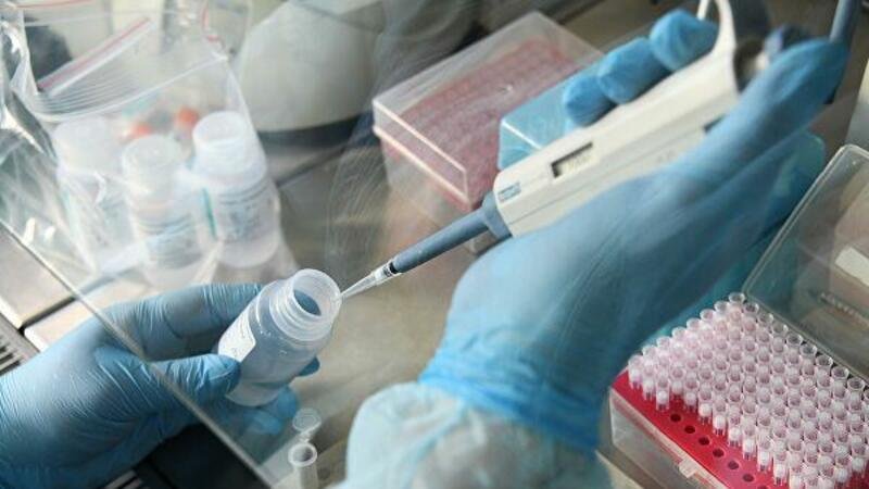 Azərbaycanda daha 168 nəfər koronavirusa yoluxdu, 5 nəfər öldü