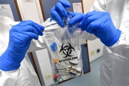 Azərbaycanda daha 4 nəfərdə koronavirus aşkarlandı