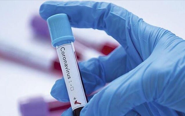 Bu dərman koronavirusu öldürür - Türk professor açıqladı