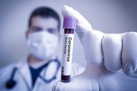 Türkiyə koronavirusun dərmanını tapdı - satılmadığı üçün istehsalı dayandırılmışdı
